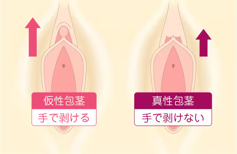 京都桂温泉 仁左衛門の湯