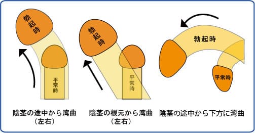 男性性器の構造とはたらき］｜家庭の医学｜時事メディカル｜時事通信の医療ニュースサイト