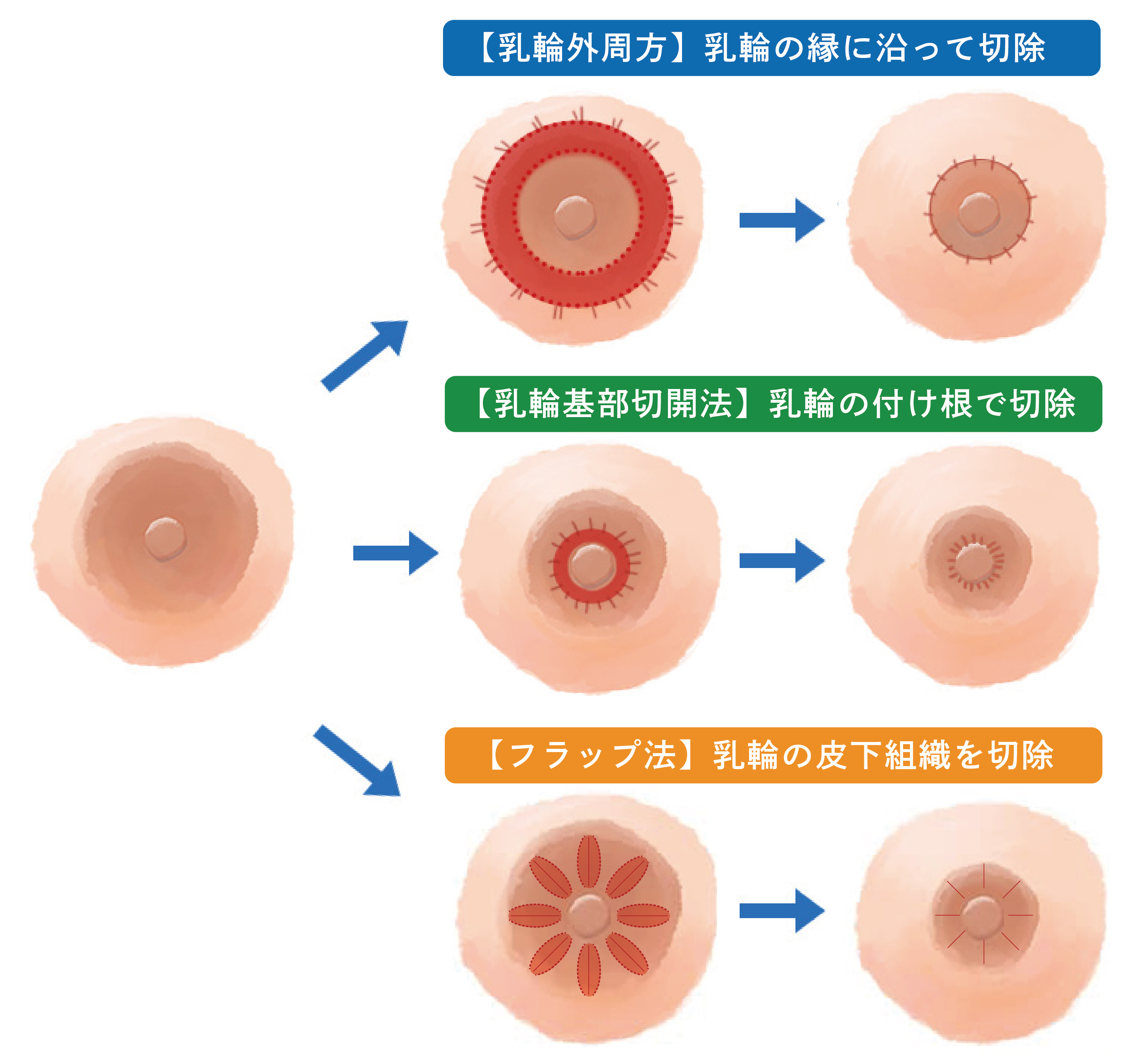 みんな大好き!男乳首 -アキバBlogに弄ばれて-（みなしそさわー）の通販・購入はメロンブックス |