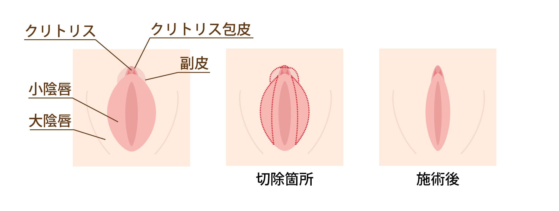 なんでもオークション