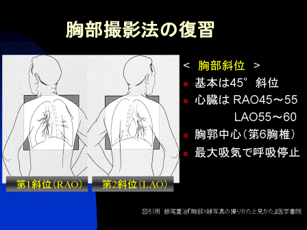 ボールを蹴ると痛む股関節 グロインペイン症候群｜股関節痛のツボ｜ツボネット 鍼灸の症例が検索できるツボ辞典