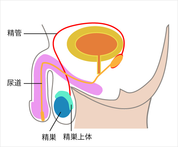 膀胱炎中にやってはいけないこととは | 浅草橋西口クリニックMo