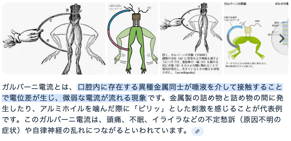 カエルの足ベクトルイラストを用いたガルバニ実験のイラスト素材・ベクター Image 143392930