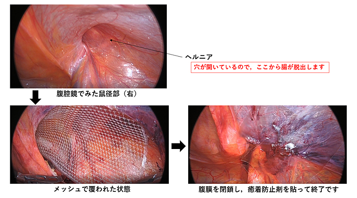 リンパマッサージで顔のむくみを解消する方法