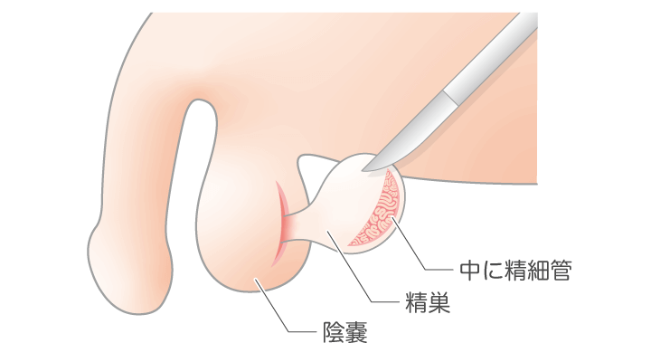 喫煙は実際にどれくらい精子に悪い？ | 英（はなぶさ）メンズクリニック｜ 男性不妊治療専門クリニック