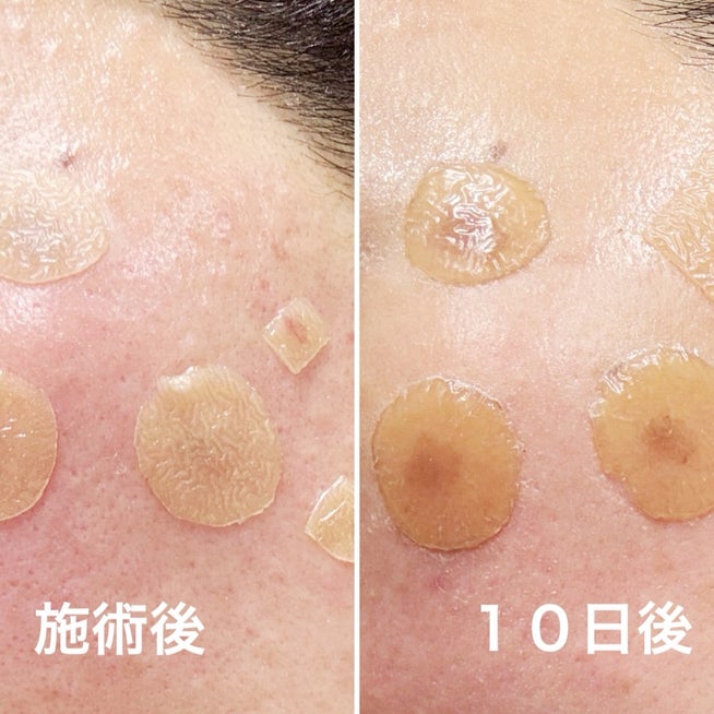 薬局で買った再生テープ韓国の美味しいごはん and・☆