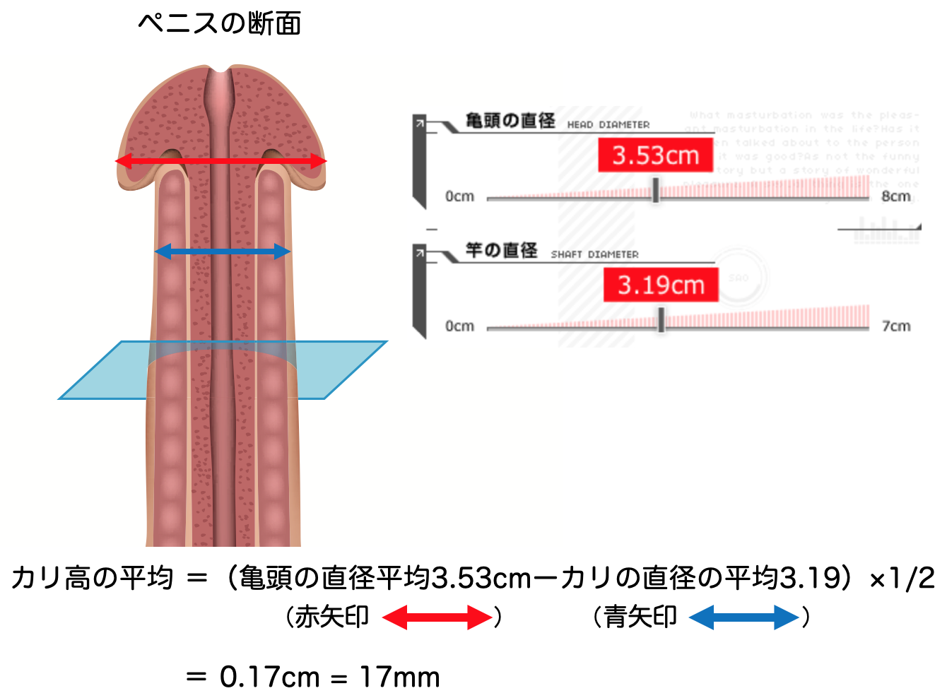 Ｇ責めカリキャップ （シングル） 格安通販 即日