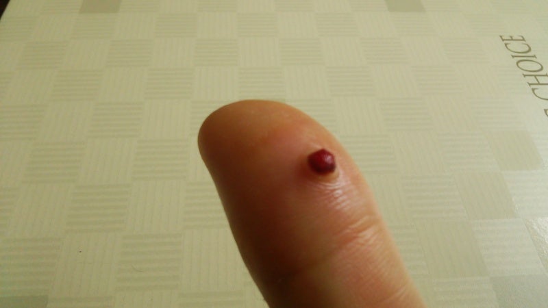 その指、詳しく診させてもらえませんか？：日経メディカル