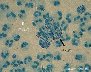 男性不妊の原因：精子の異常・基準値について｜男性不妊｜医療法人オーク会