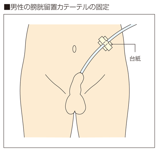 勃起の筋トレ 骨盤底筋トレーニングで勃起力を改善させよう -