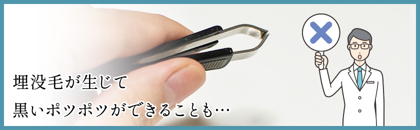 陰毛を抜いてはいけない理由を解説！脱毛方法やメリットを解説 | お役立ち情報 |