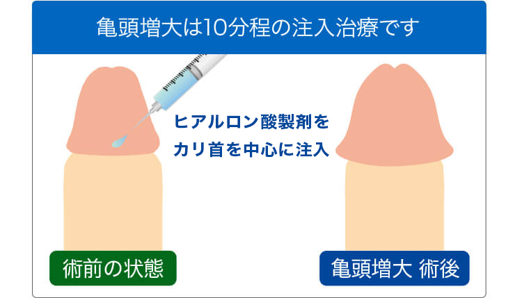 ペニス強化（亀頭増大・陰茎増大） | 診療案内