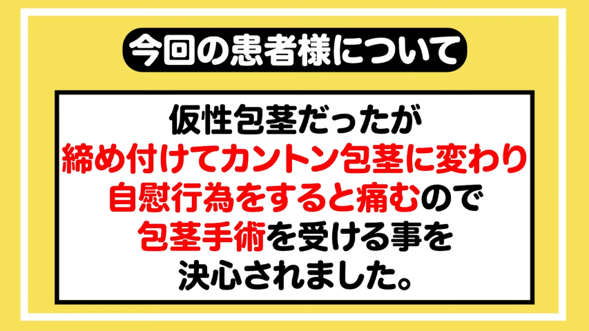 ノンケ動画】トイレの上から その4 幼さ残る仮性包茎からのデカチンコオナニー！