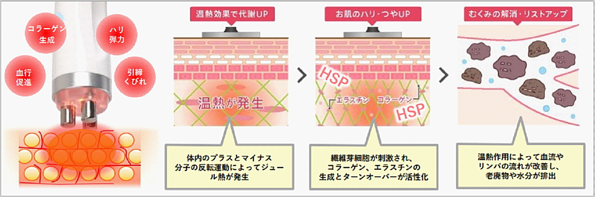 メナードフェイシャルサロン フレンドリー 福岡県北九州市小倉北区- フェイシャルエステ実施店