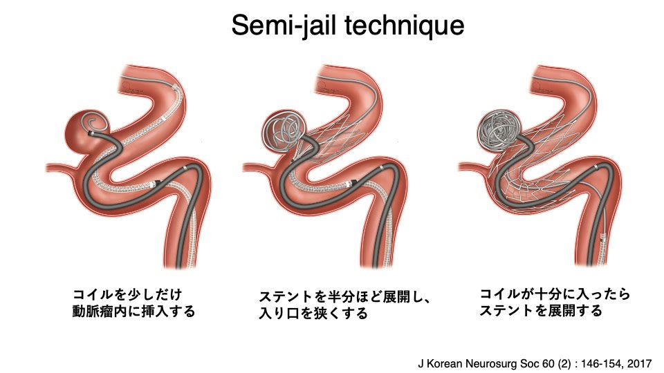 消化器内視鏡 16年4月号 (発売日2016年04月25日)