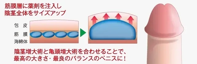 ペニスを大きくする方法は？増大サプリや器具、オナ禁の効果も解説 | 包茎手術のノーストクリニック【公式】