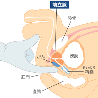 女講師の尻穴に直接指やバイブを挿れてドライオーガズムの方法を学ぶ若手ナースたち♡ - おなごパラダイス