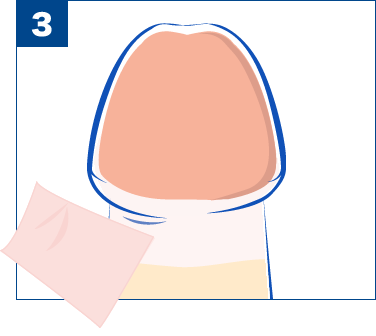 亀頭が痛い、敏感すぎるのは包茎が原因？包茎治療や自力での改善方法を紹介 | メンズライフクリニック【公式】