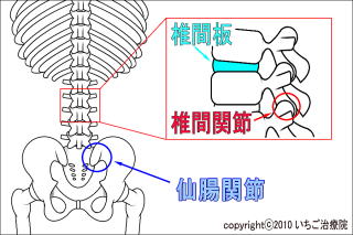 コルセット 腰痛対策 腰痛防止