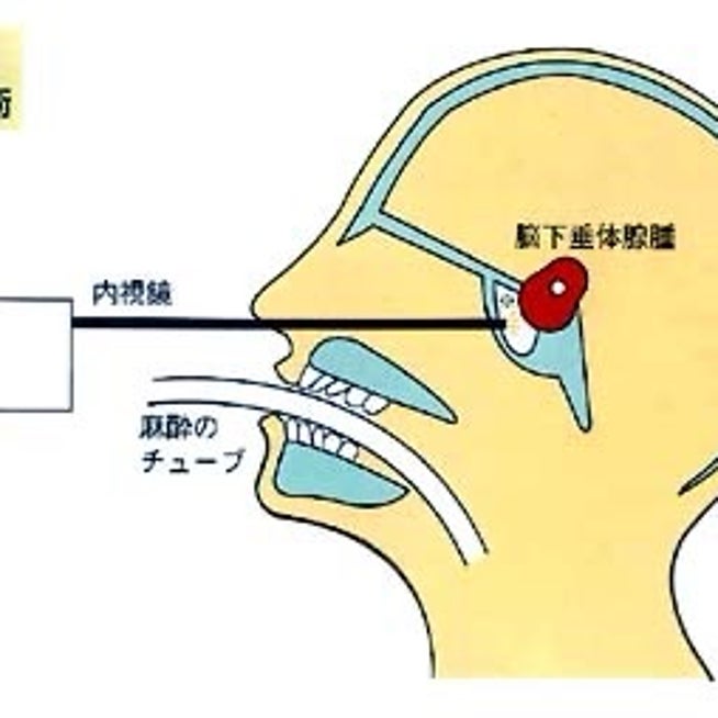 産後の不安を解消！うつ・骨盤の開き・たるみお腹・むくみ…原因や対策を専門家が解説 | 美的.com