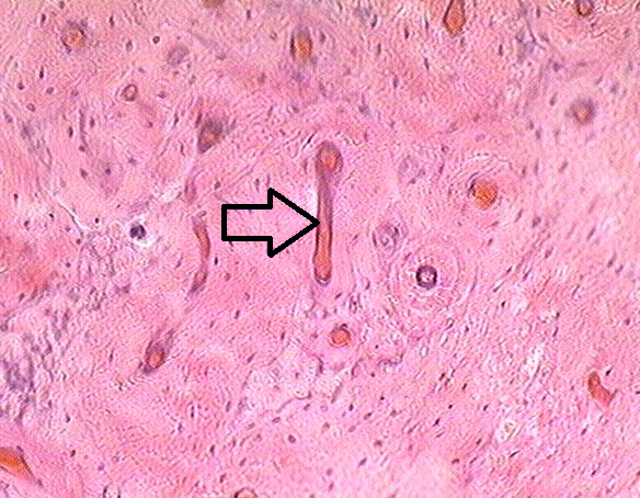 特定の骨部分ハバース管骨髄腔のベクトル図Premiumベクトル素材