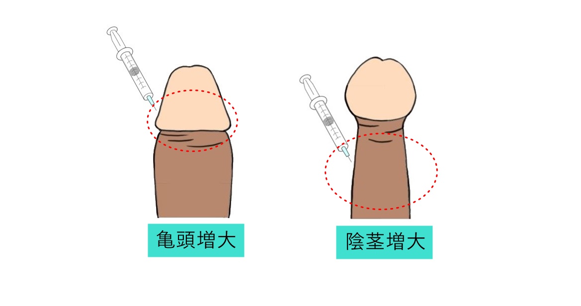 Amazon | EX日焼けギャル ましましカリ刺激 トイズハート