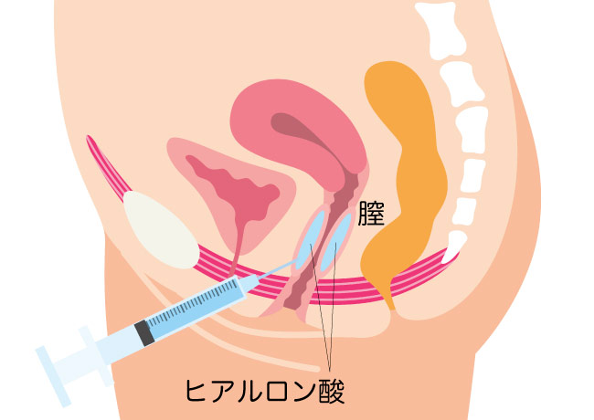 クリトリスの場所はどこ？構造・役割と快感を感じるためのいじり方 | Ray(レイ)