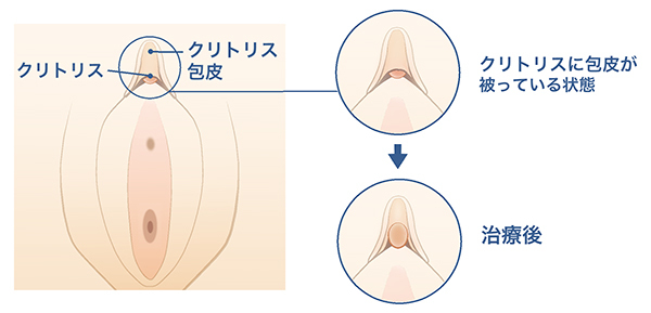 気だるげ面接官によわよわクリトリスを責められちゃう話 [透明薬局] | chobit(ちょびっと)