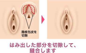 クリトリスの場所はどこ？構造・役割と快感を感じるためのいじり方 | Ray(レイ)