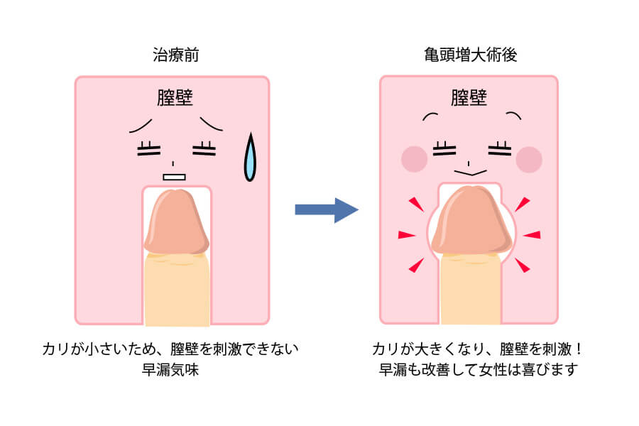 カリ高ちんこ最高♡女性が虜になるカリ高の基準と増大方法 | 男の美学