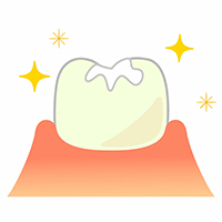 歯医者で聞くシーラントとは？・伊勢崎市羽黒町にある歯医者 神戸歯科医院のブログ