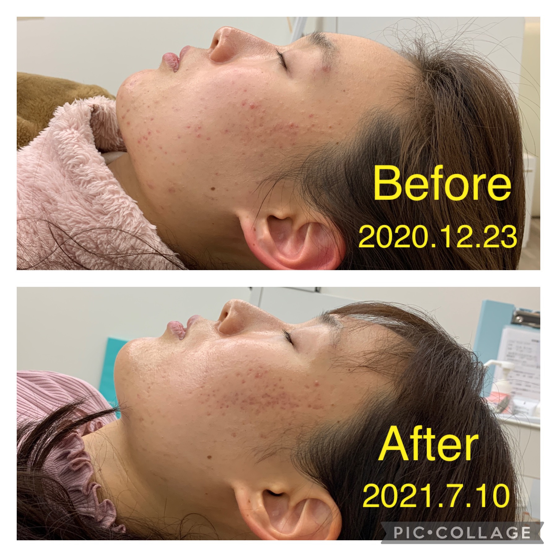 イラスト素材：スーツの女性が困った表情でお手上げ状態を表現する様子 上半身 単色 線画のイラスト素材81825178- PIXTA