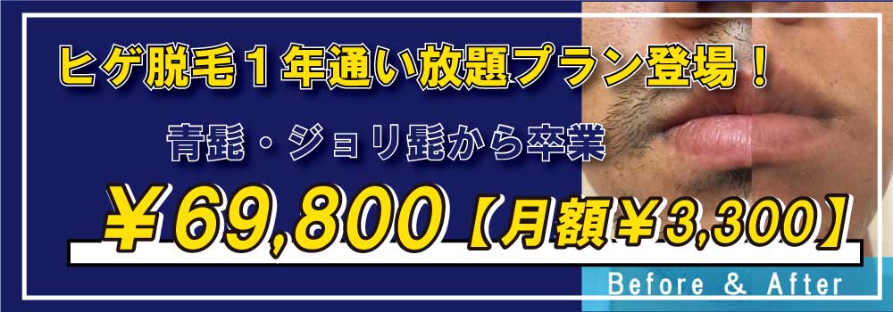 2024年最新】大阪のヒゲ脱毛おすすめクリニック&サロン11選｜安く抑えるポイントや口コミをご紹介 | The Style Dictionary