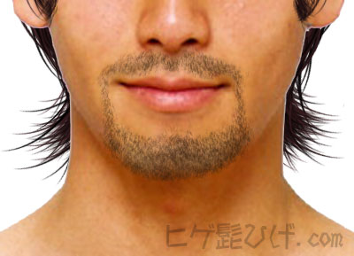 ヒゲ脱毛後のどろぼうひげは何回目まで出る？濃く見える期間と対処法を解説 - MABi