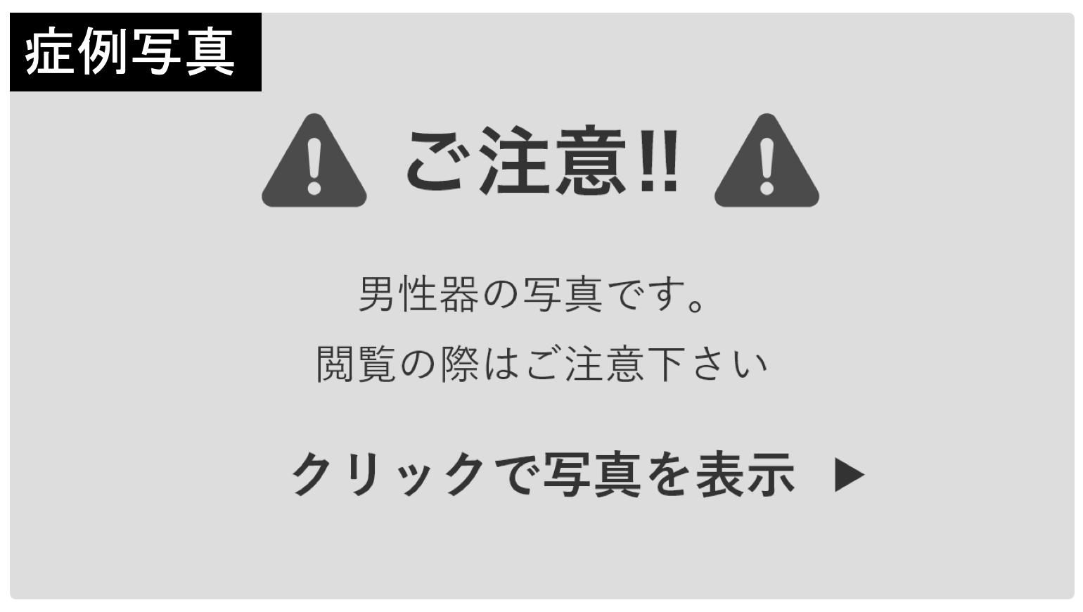 俺のち〇こはツチノコタイプ弾丸型だ。」形に注目！ちん形状図鑑｜BLニュース ちるちる