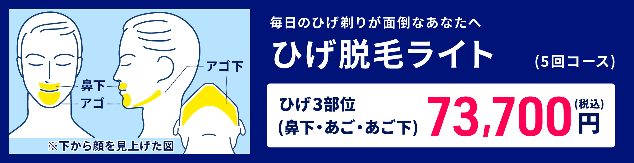 メンズのもみあげ脱毛のデザインを決めるポイントや人気の形を紹介！ - 小山市でメンズ脱毛なら脱毛サロンARCAへ