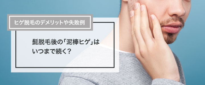 衝撃 脱毛後の泥棒ヒゲとヒゲが抜け落ちる様子！ - YouTube