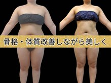 痩身エステと食事の重要な関係性｜何を食べる？タイミングや頻度は？ | セルライトのススメ