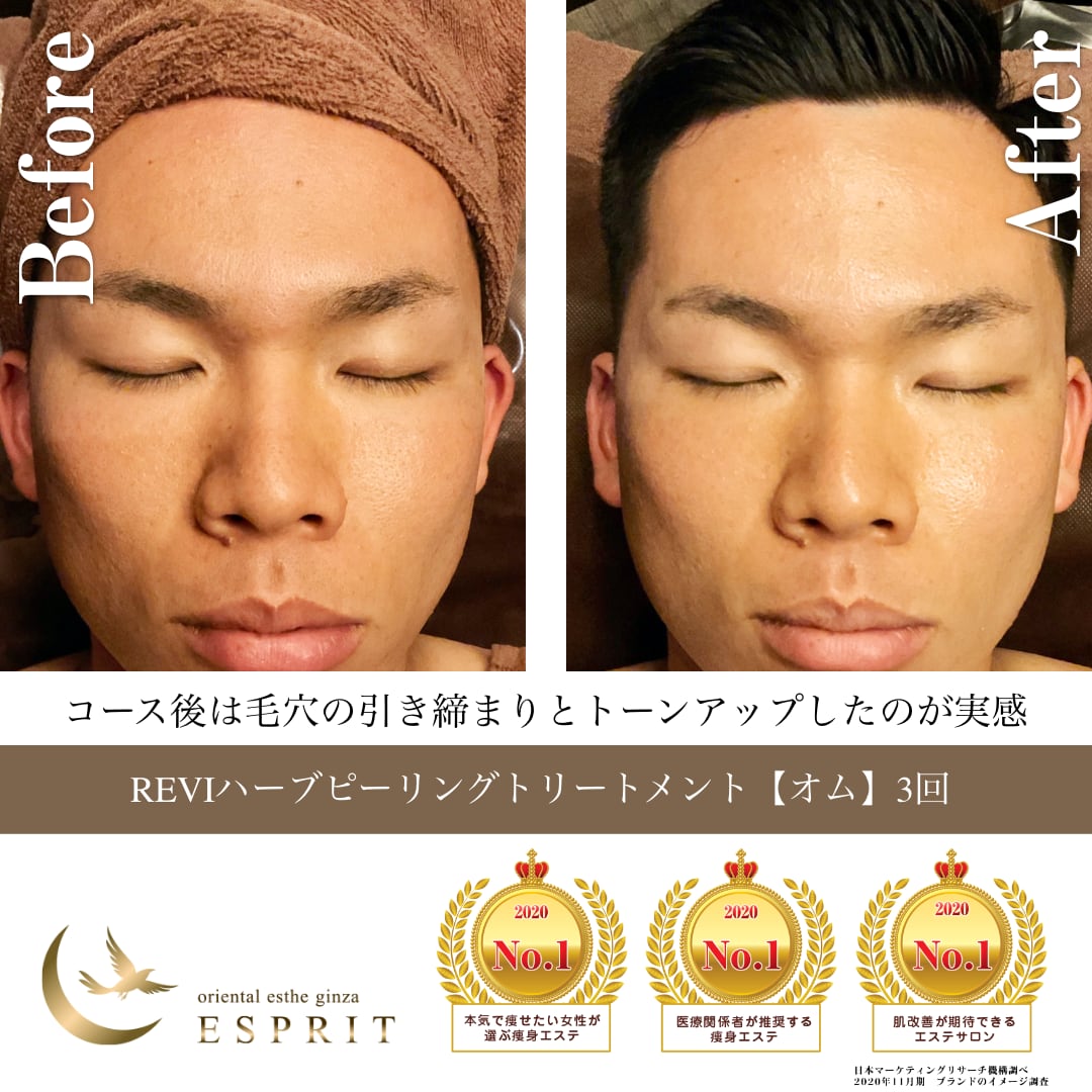 💆男性フェイシャルエステをスタート致しました💆】 ⁡ 初めまして😌 POLAアピタ新潟西店です♪ 当店では、男性のお肌