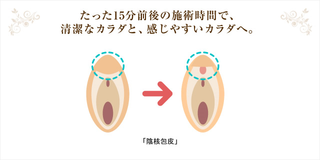 小陰唇のお悩み|福岡ブリスクリニック