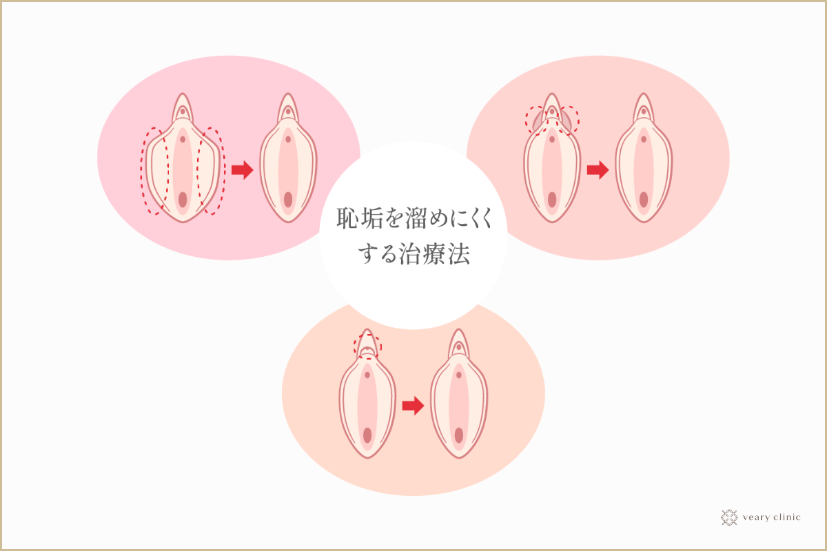 クリトリスを徹底解説！１番感じる刺激法とは？ – メンズ形成外科