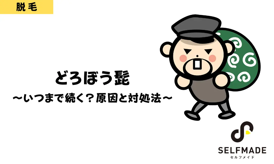 ヒゲ脱毛後のどろぼうひげは何回目まで出る？濃く見える期間と対処法を解説 - MABi