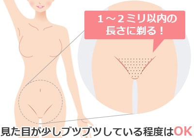 VIOの正しい自己処理方法！ツルツルにするやり方は？必須グッズ・手順も紹介