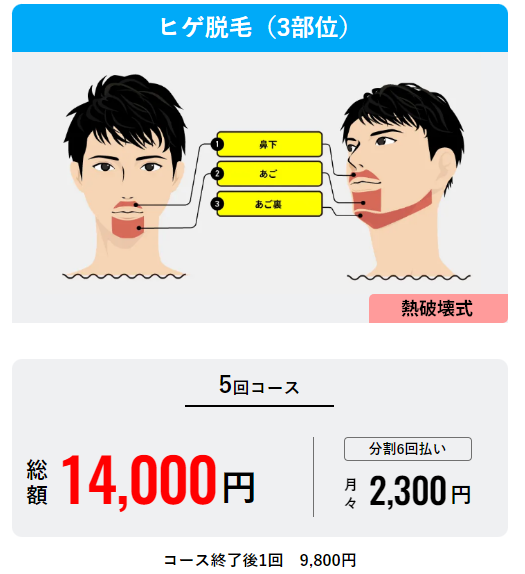 2024年最新】大阪のヒゲ脱毛おすすめクリニック&サロン11選｜安く抑えるポイントや口コミをご紹介 | The