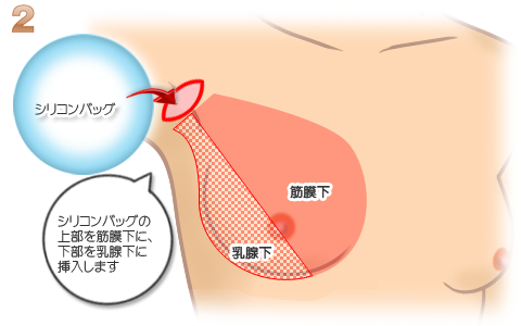 Amazon.co.jp: 304ステンレススチールスクリュートゥーススリーブワイヤースレッド修理保護コイルドヘリカルスリーブ  M1.6M2M3M4M5M6〜M24スレッド挿入a2