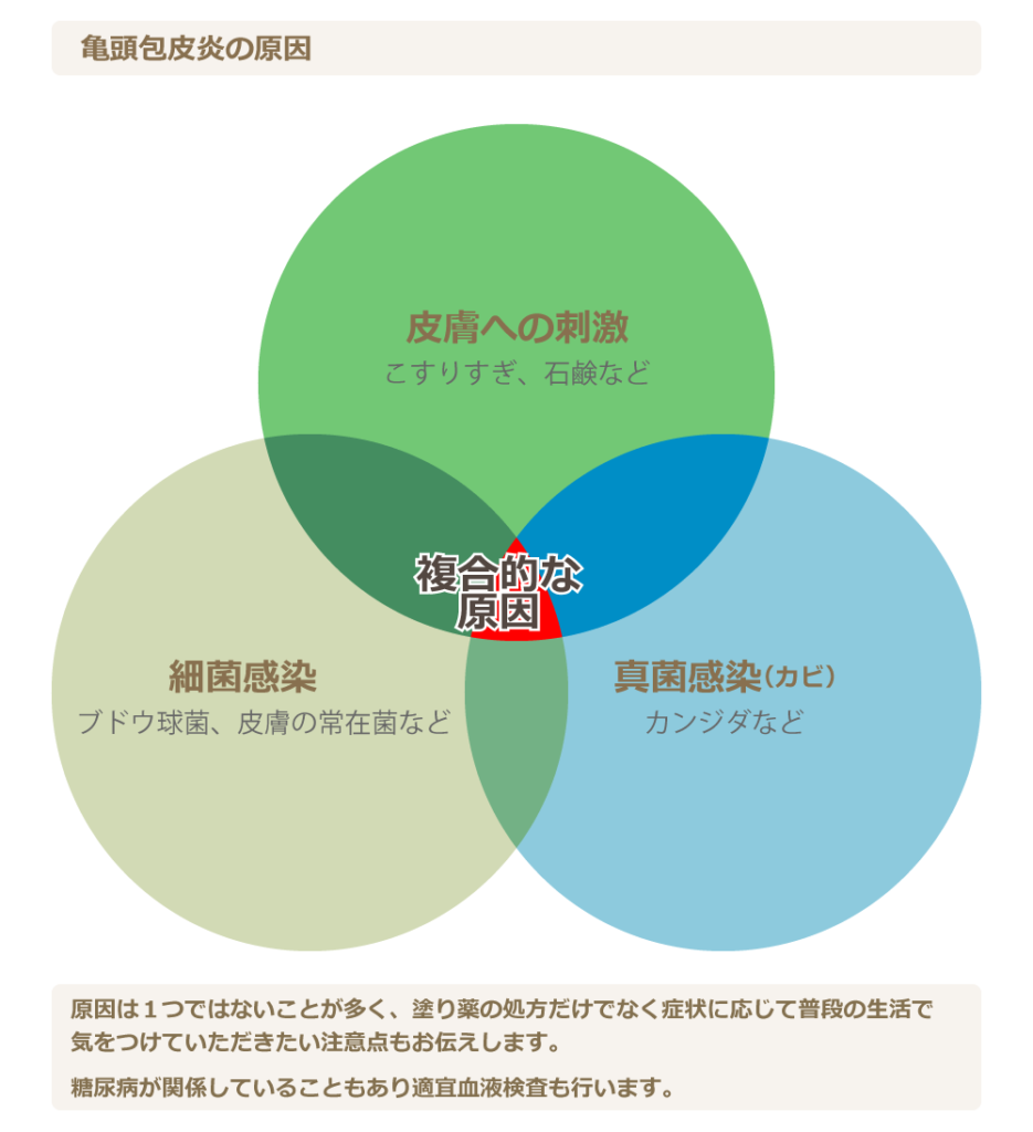 包茎手術について 静岡 橋本クリニック |