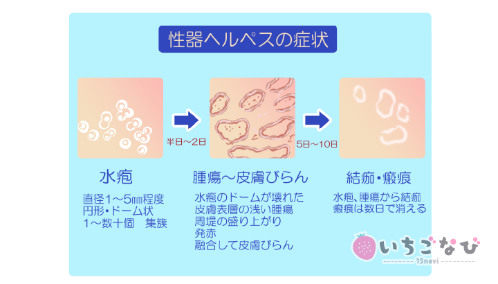 ヘルスで性病!?】ファッションヘルスで感染しやすい性病4つと安全にヘルスに通う3つのポイントを解説 – サコダ・レディースクリニック