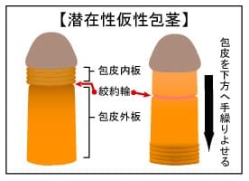 楽天市場】包茎（本・雑誌・コミック）の通販