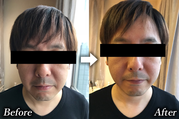 40代からの男の目元ケア】老け見えの元凶「シワ」を改善＆予防する方法 | UOMO