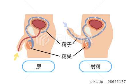 夢精したくないのですがどうすれば夢精しなくなるんでしょう？ - この